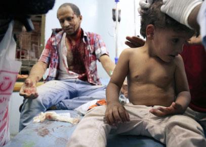 العدوان يجهز على مستشفيات اليمن:  استهداف 289 مرفقاً صحياً