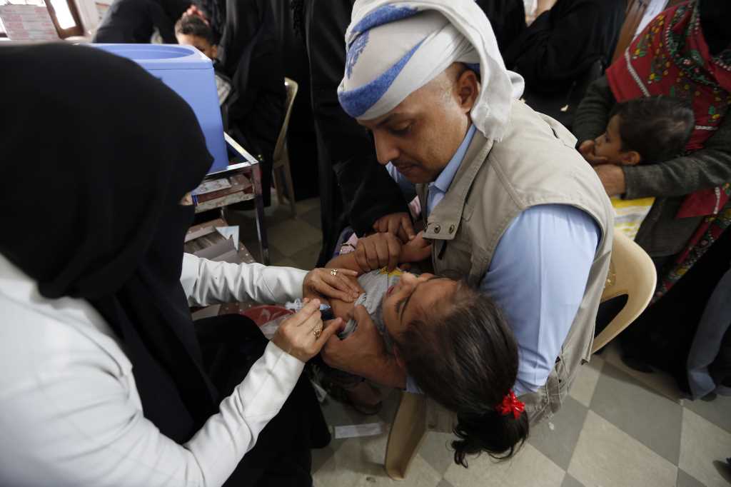اليمن هو من أكثر الدول التي تعاني من الجوع جراء العدوان