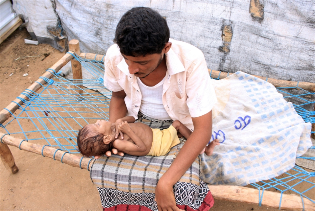 الأمم المتحدة: اليمن على أعتاب «مجاعة كبرى»