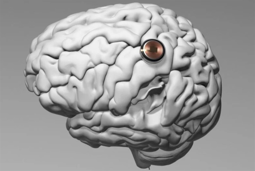 الذكاء الاصطناعي يندمج في الدماغ البشري؟