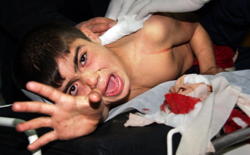 طفل فلسطيني يصرخ في مستشفى في بيت لاهيا شمال قطاع غزة أمس (ثائر الحسني - أ ب)