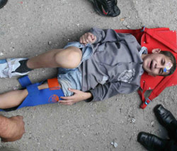 الطفل المصاب خلال إسعافه امس (خالد الغربي)