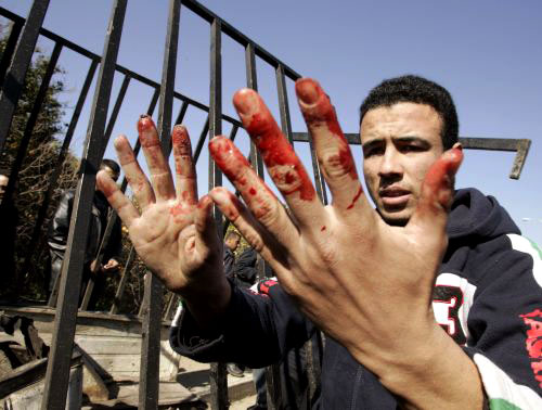 دماء على يدي فلسطيني بعد الغارات الإسرائيلية على غزّة أمس (محمّد سالم ـ رويترز)