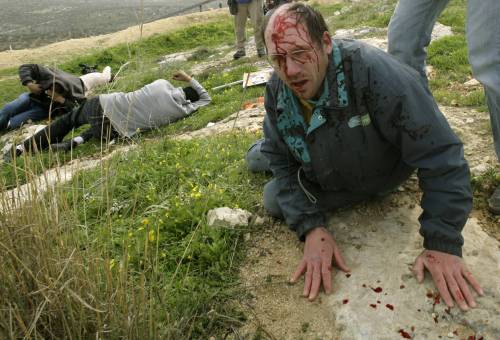 ناشط سلام أميركي مصاب بطلقات إسرائيليّة في قرية بلعين الجمعة الماضي (يانيس بهراكيس ـ رويترز)