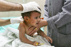 طفلة فلسطينية تتلقّى العلاج بعد غارة إسرائيليّة في أحد مستشفيات غزّة الشهر الماضي (محمود حمس ـ أ ف ب)