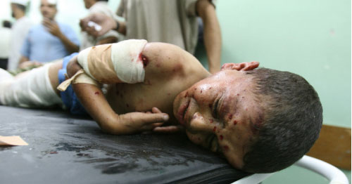 طفل فلسطيني جريح في أحد مستشفيات غزّة أول من أمس (محمد عبد ـــ أ ف ب)