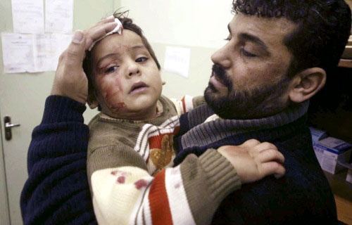 طفل فلسطيني في أحد مستشفيات غزّة بعد إصابته بشظايا صاروخ إسرائيلي أمس (إبراهيم أبو مصطفى ـ رويترز)