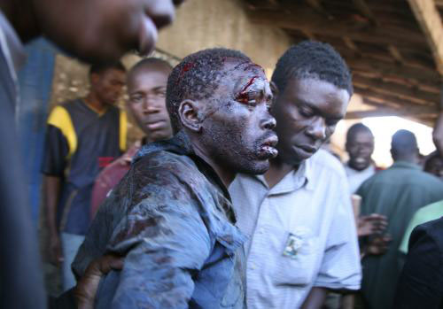 كيني جريح إثر أعمال العنف في العاصمة نيروبي أوّل من أمس (رويترز)