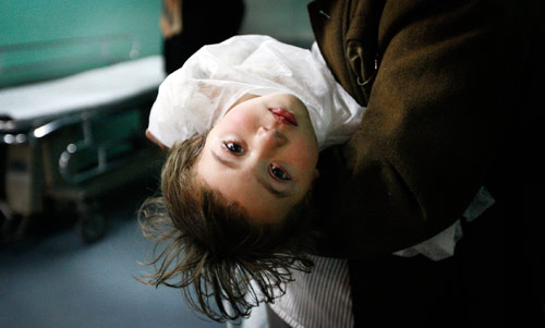 طفلة فلسطينية جريحة في مستشفى الشفاء في غزة أمس (أنجا نيادرينغوس - أ ب)