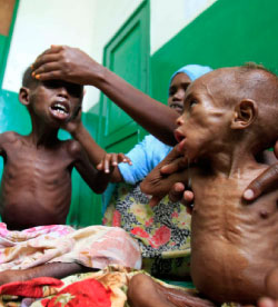 أطفال يعانون من سوء التغذية في إحدى مستشفيات مقديشو (اسماعيل تاكستا ــ رويترز)  