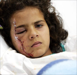 طفلة جريحة خلال العدوان الإسرائيلي في مستشفى بيروت الحكومي (وائل اللادقي)