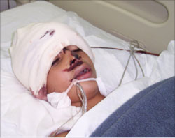 الطفل محمد ناجي الذي توفي امس متأثراً بجراحه